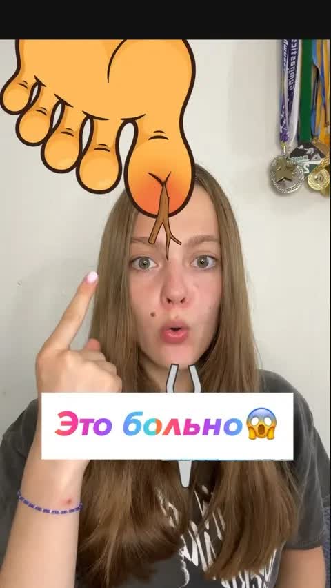Это больно😱